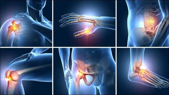 Chữa bệnh đau xương khớp Chữa bệnh đau xương khớp