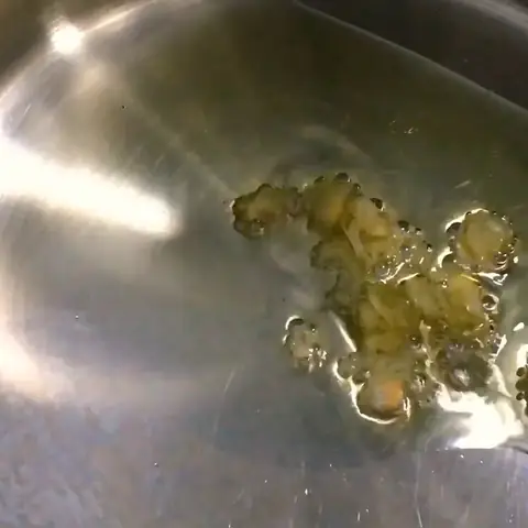 Xào Gan Và Cải Xào Gan Và Cải