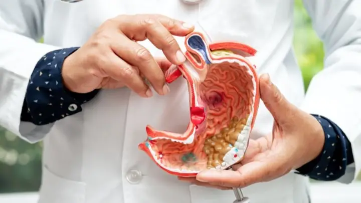 2nghệ Có Chữa Đau Dạ Dày Không?