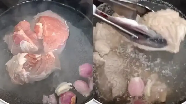 Chần xương ống