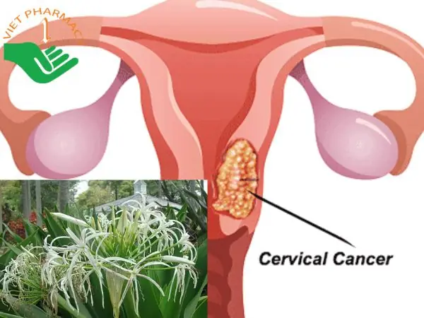 Cách Nấu Nước Là Trinh Nữ Hoàng Cung Tươi Trị Ung Thư Vú, Ung Thư Cổ Tử Cung