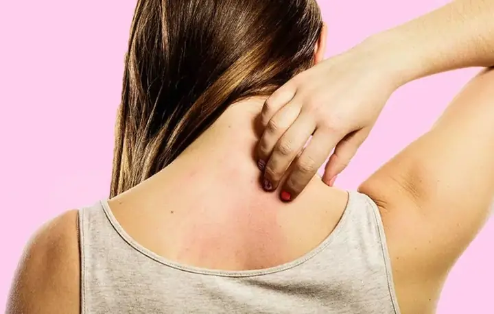 Hỗ Trợ Giảm Viêm Và Dị Ứng